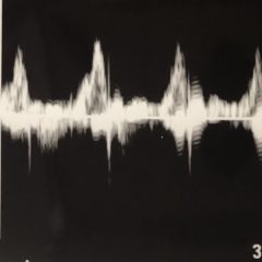 Congenital Heart Anomaly Mommy